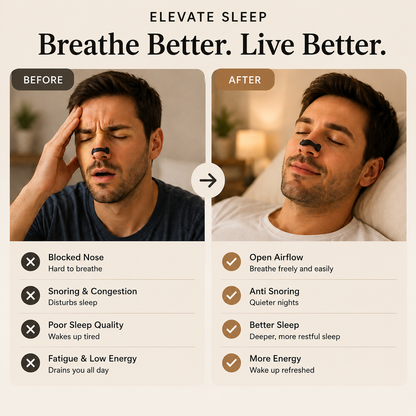Elevate™ Anti-Snore Nasal Kit